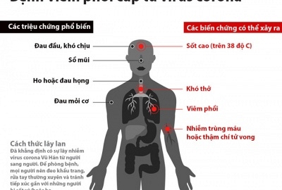 Thông báo về việc lùi lịch học và phòng, chống dịch viêm đường hô hấp cấp do chủng mới của virus corona gây ra